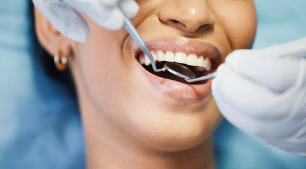 Best After-Hours Emergency Dentist in Linglestown, PA